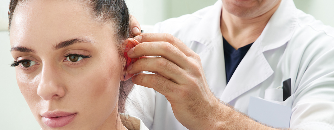 OTOPLASTY OTOPLASTY