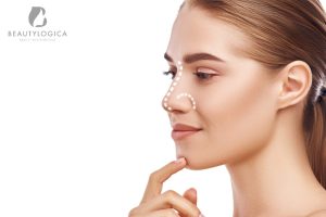 Operasi Mengecilkan Hidung Besar dan Lebar
