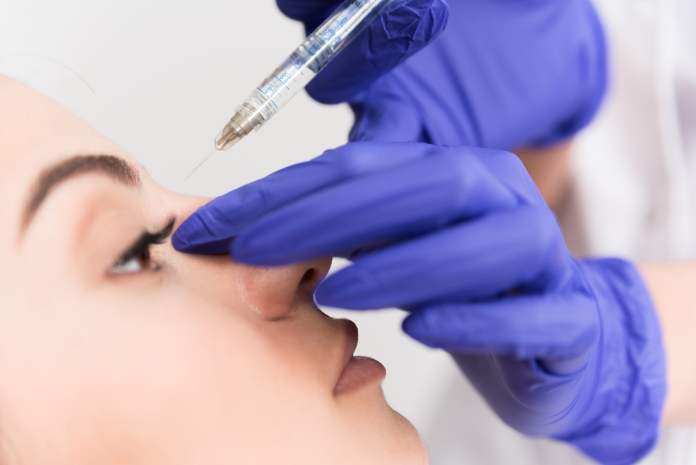 Perbedaan Filler Hidung dan Operasi Hidung