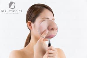 Cara Mengecilkan Pori-pori di Hidung