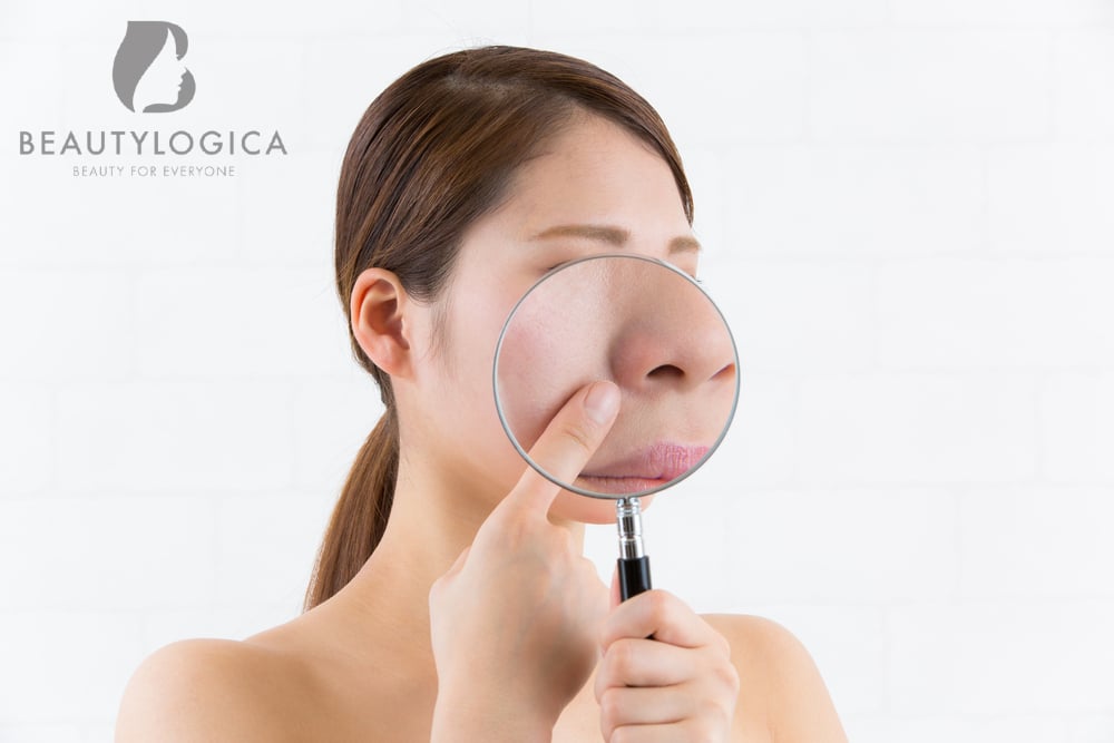 Cara Mengecilkan Pori-pori di Hidung