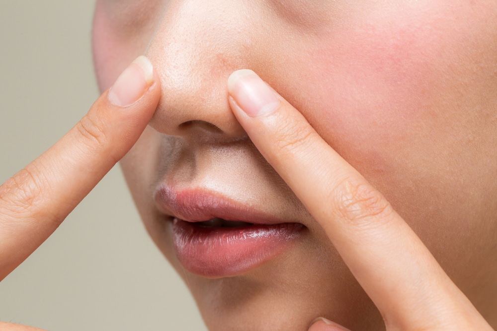 Mengatasi pori-pori besar di hidung