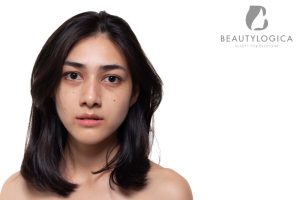 cara supaya kulit tidak kusam
