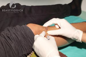 Cara Menghilangkan Bekas Luka di Kaki Paling Ampuh