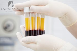 Apa itu PRP Injection Simak Penjelasan Lengkapnya di Sini!