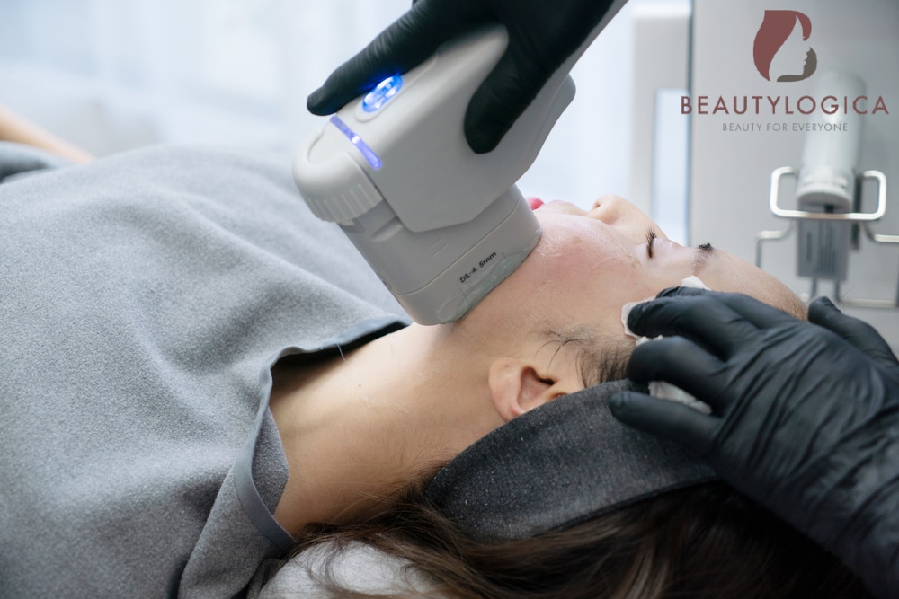 Review HIFU Wajah di Klinik Kecantikan
