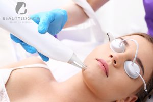 Treatment Menghilangkan Flek Hitam di Wajah dengaan Dokter