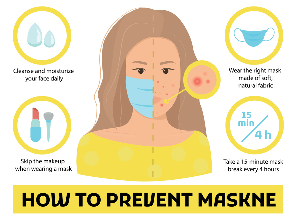 Bagaimana Cara Mencegah Maskne