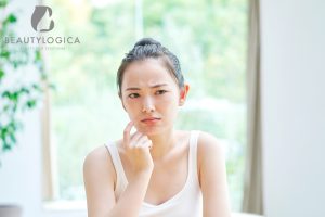 Cara Mengatasi Kulit Wajah Kering dan Kusam yang Wajib Kamu Ketahui