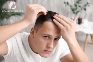 Cara mengatasi kebotakan dini agar tidak terlalu parah
