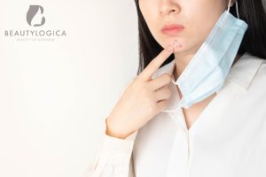 Pakai masker malah jerawatan, ternyata ini penyebabnya