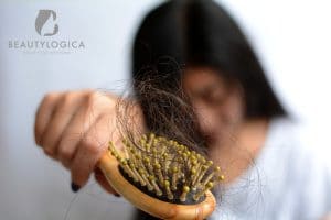 Perawatan untuk Mengatasi Rambut Rontok Parah