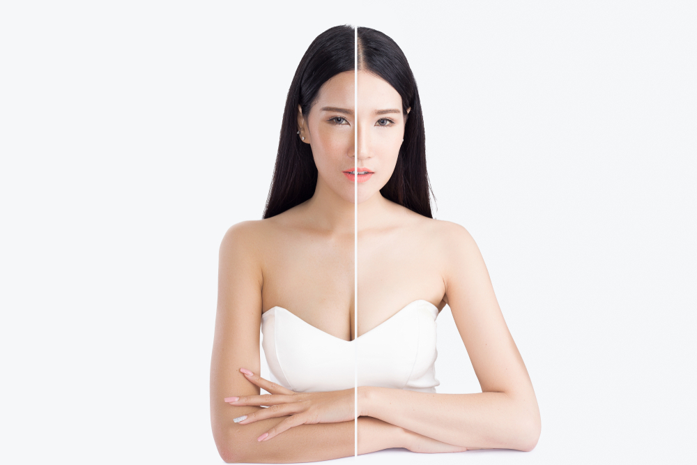 Tips memutihkan kulit ala klinik kecantikan