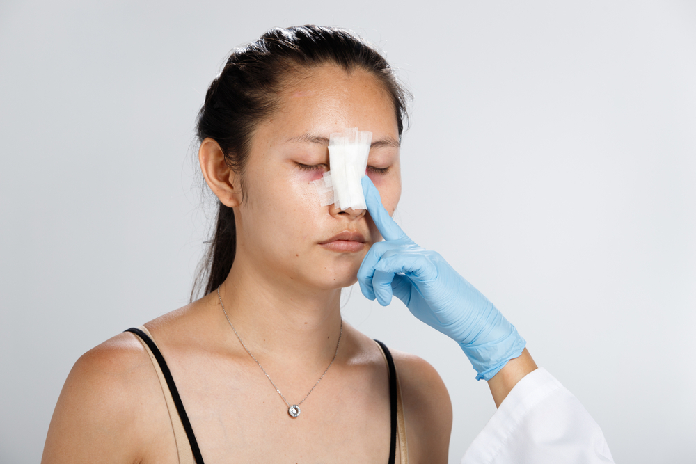 Ciri filler hidung gagal