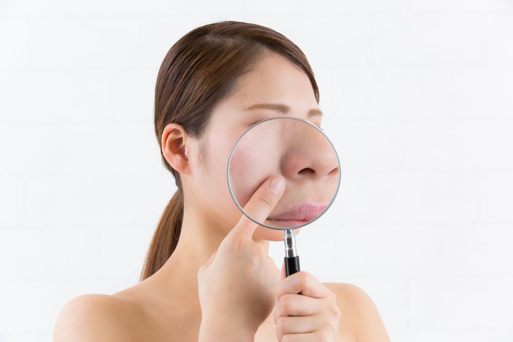 Berapa lama jerawat di hidung akan hilang