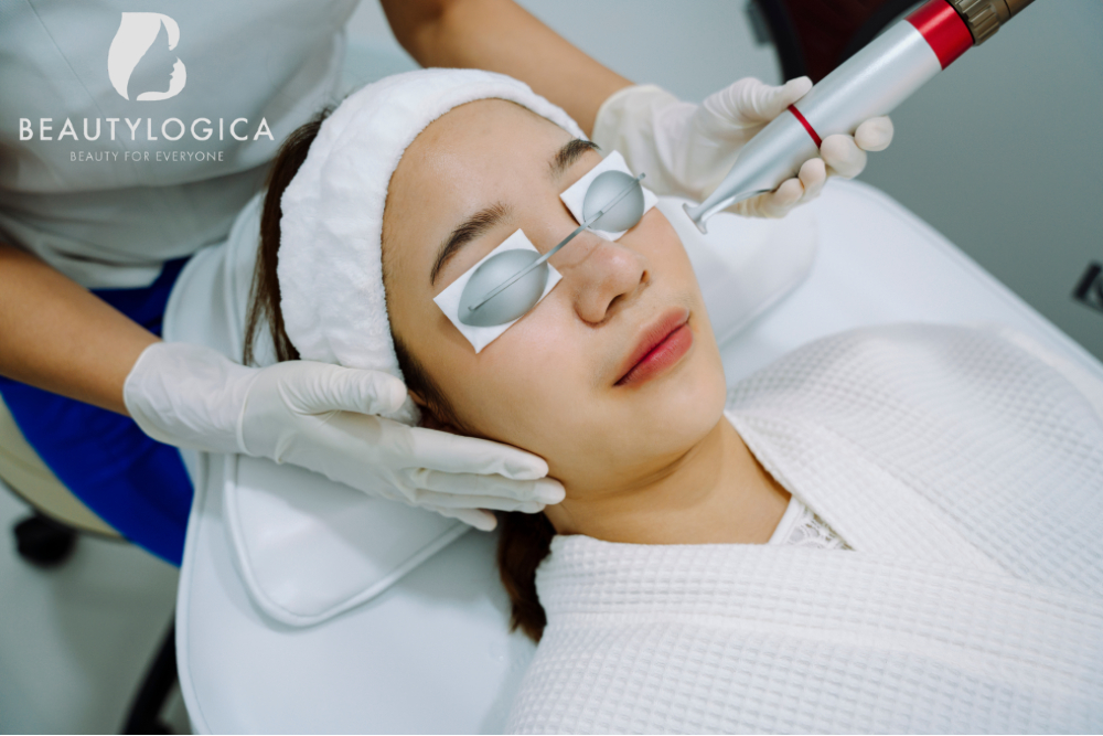 Biaya perawatan laser untuk milia