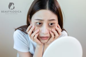 Cara menghilangkan kantung mata dan mata panda