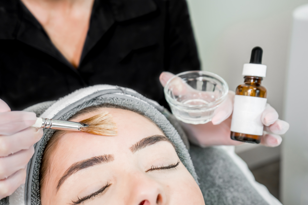 Chemical Peeling adalah