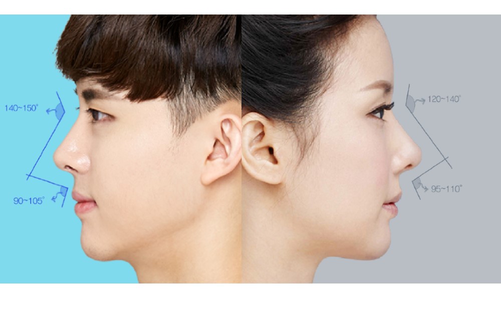 Review before after operasi hidung
