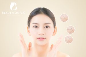 Cara Mengatasi Kulit Wajah Kering dan Mengelupas