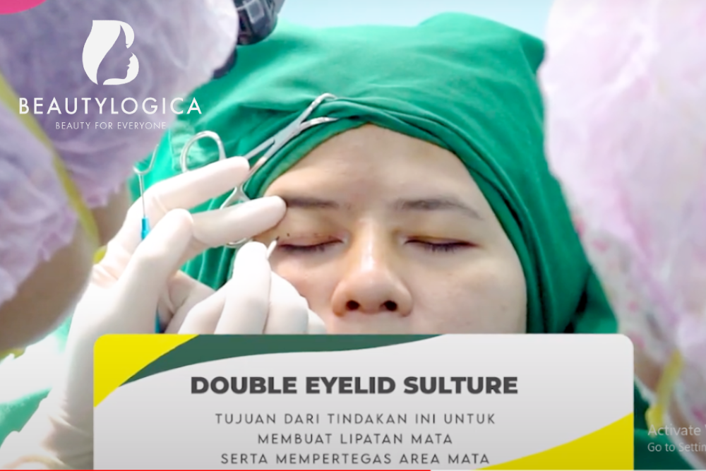 Harga Operasi Kelopak Mata di Indonesia