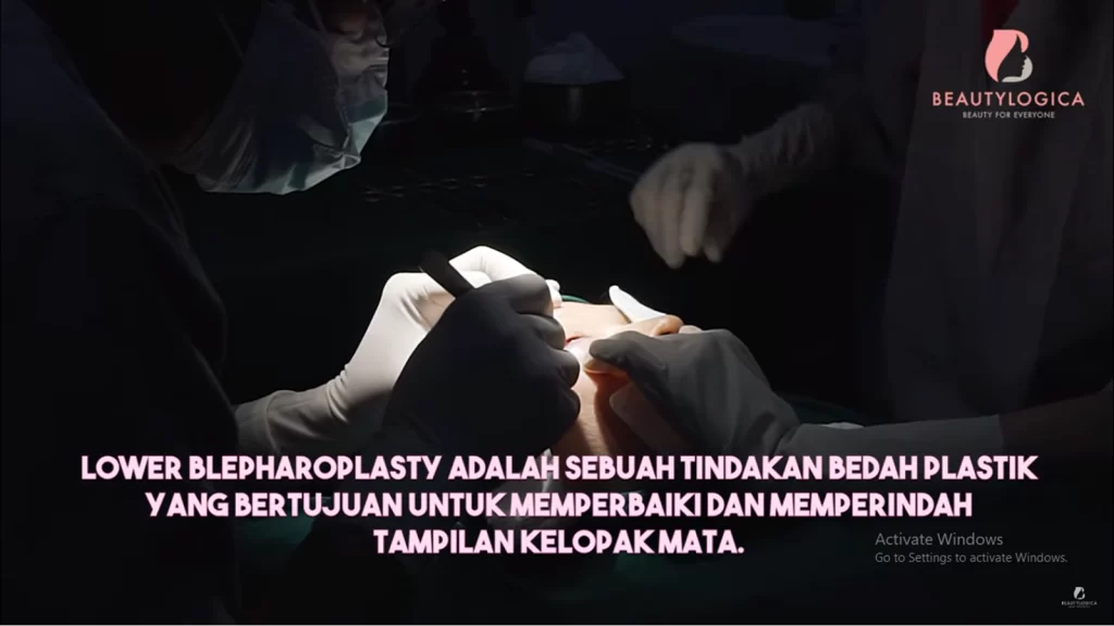 Prosedur Operasi Kantung Mata