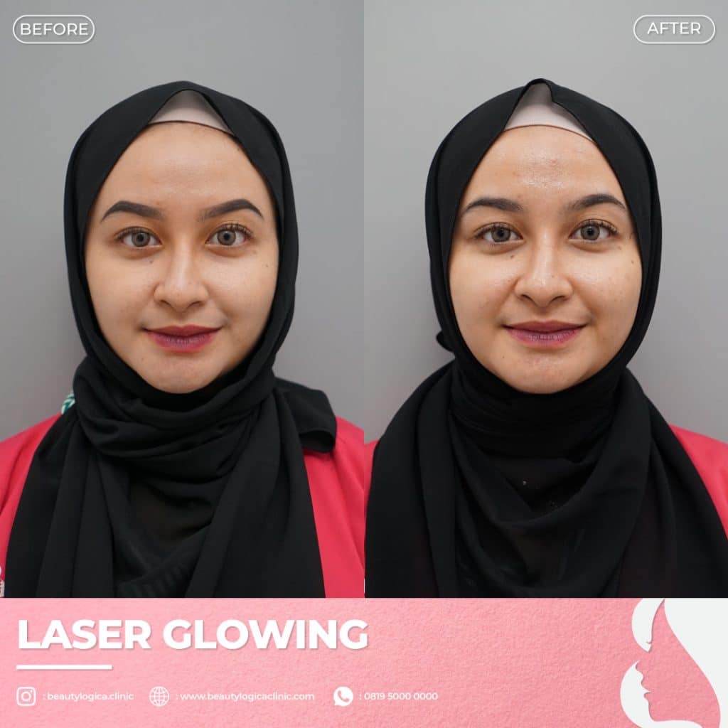 Manfaat Treatment Wajah di Klinik Kecantikan