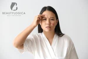 Benarkah Wajah yang Mudah Berjerawat Biasanya Dialami pada Masa Puber