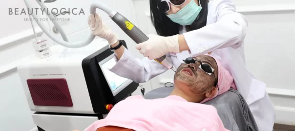 Treatment Laser Wajah