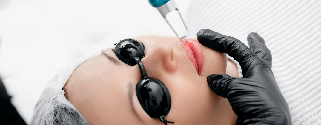 Laser Bibir Laser Pink Lip - Laser Bibir